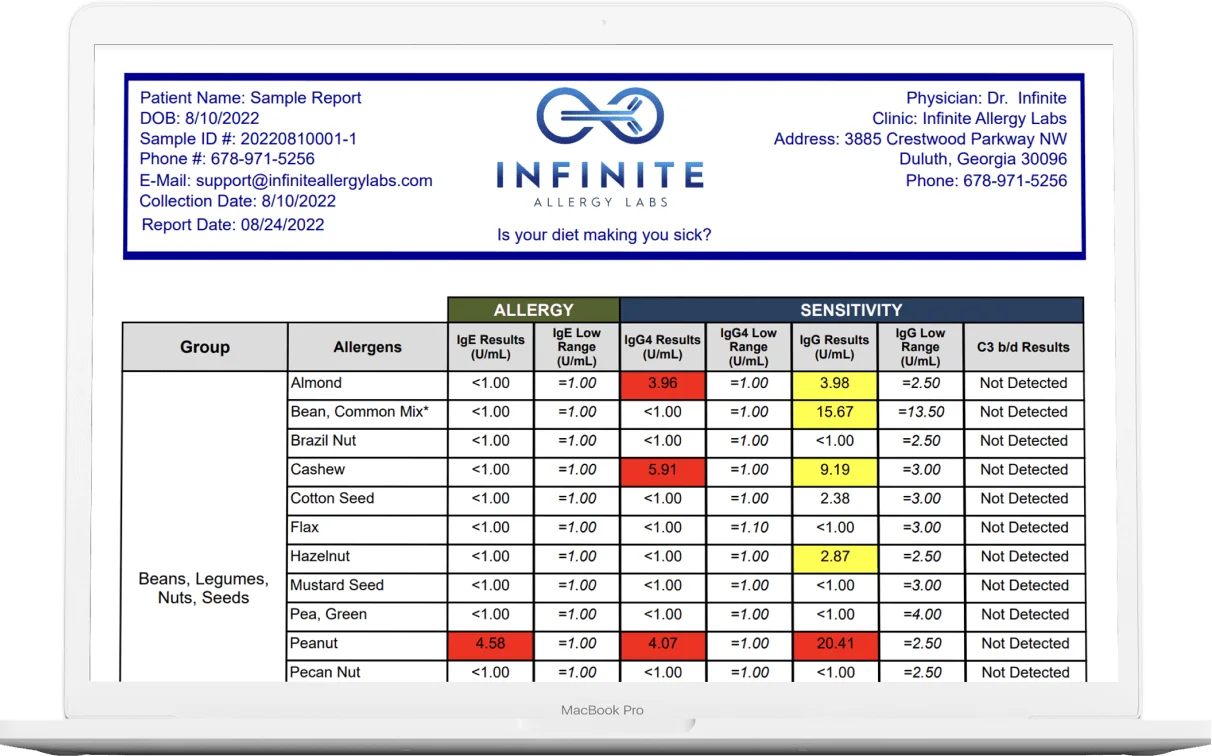 Allergy test kit sample report